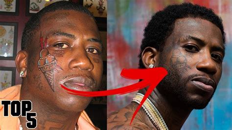 gucci mane before and after.